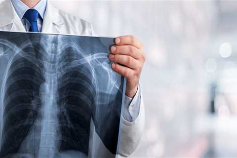 How long does it take to resolve a case of mesothelioma?