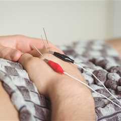 Electro Stim Acupuncture Machine