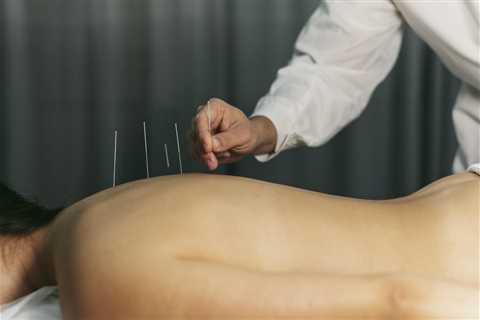 A COMPREHENSIVE GUIDE TO ACUPUNCTURE FOR CANCER PATIENTS