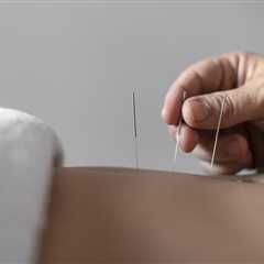The Benefits of Acupuncture in Digestive Disorders
